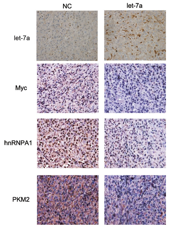 Let-7a inhibits glioma growth