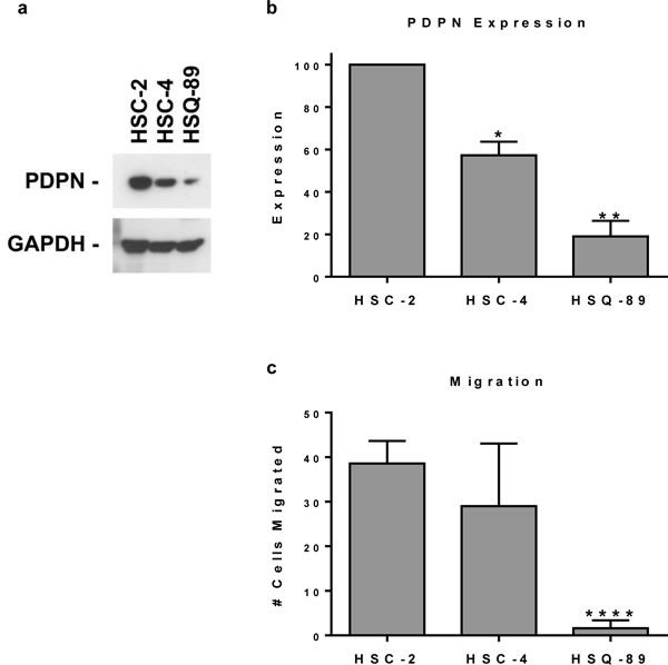 Pdpn expression correlates with OSCC cell motility.