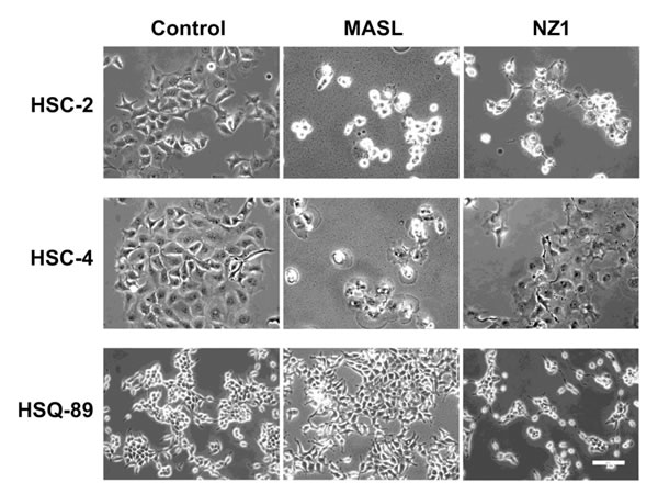 Effects of NZ-1 and MASLon OSCC cell morphology.