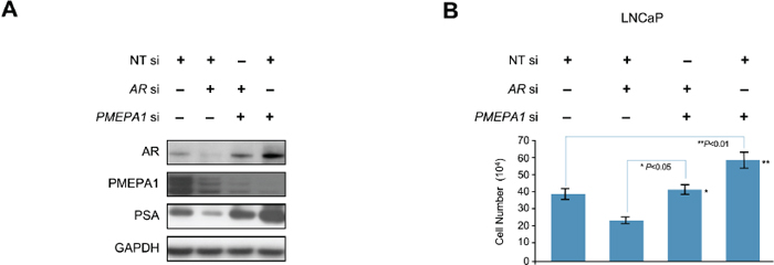 PMEPA1 silencing rescues AR inhibition in prostate cancer cells.