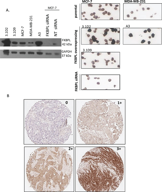 Optimisation of FKBPL antibody for IHC.