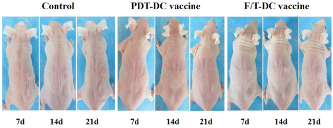 Anti-tumor immunity of PDT-DC vaccine.