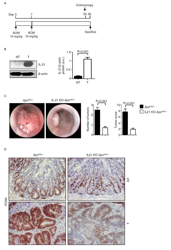 IL-21 deficiency significantly reduces colon tumorigenesis in
