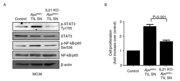 STAT3/NF-kB activation and increased proliferation are seen in mouse CRC cells cultured in the presence of TIL-derived supernatants (TIL SNs) obtained from