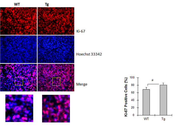 HSPA12B increased cell proliferation in lung tumors.