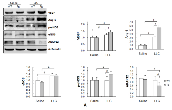 HSPA12B upregulated the expression of Cox-2, VEGF and Ang-1, increased the phosphorylation of eNOS, while decreased expression of AKAP12 in lung tumors.