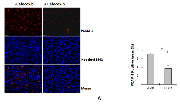 Cox-2 inhibitor celecoxib reduced angiogenesis and proliferation, and increased apoptosis in Tg lung tumors.