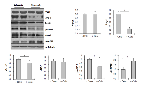 Cox-2 inhibitor celecoxib decreased Ang-1 expression, reduced eNOS activation, and increased AKAP12 expression in Tg lung tumors.
