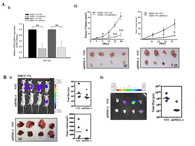 Silencing of PIM1 suppressed the tumor volume and metastatic ability