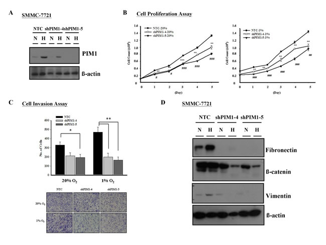 Silencing of PIM1 inhibited cell proliferation and invasiveness in HCC (SMMC-7721).