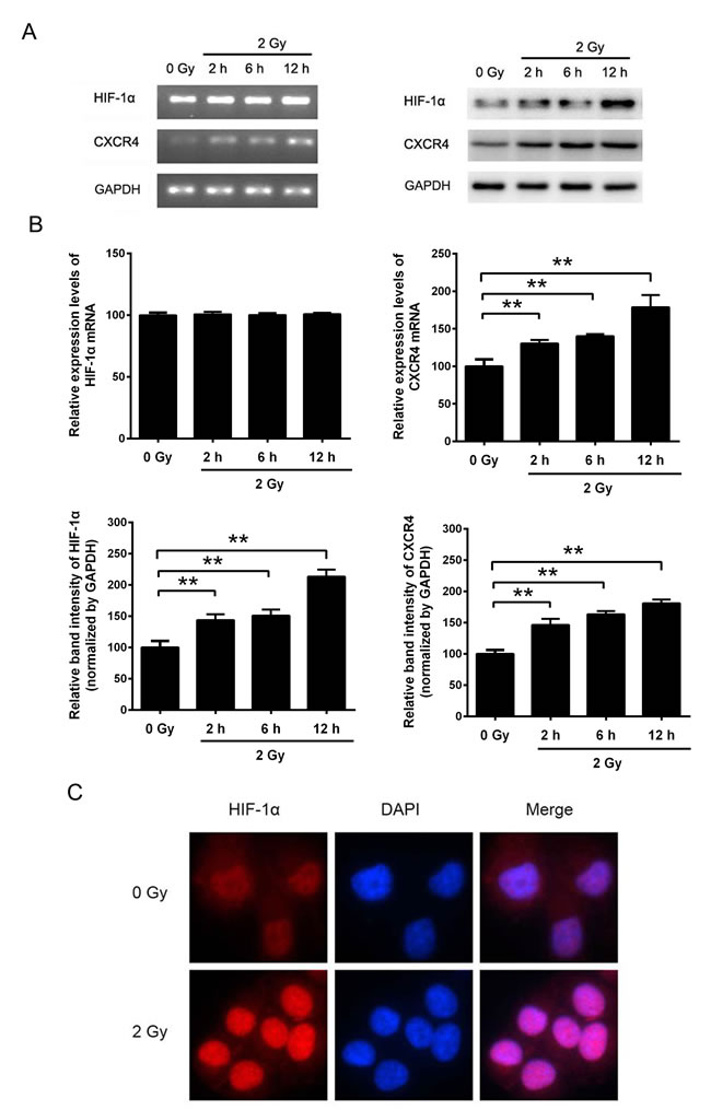 The expression levels of HIF-1&#x3b1; and CXCR4 in H1299 cells were increased by X-ray irradiation.