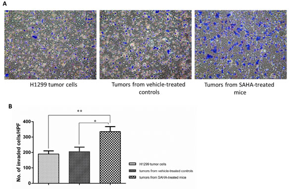 Continuous administration of SAHA increased the invasion ability in ALDH