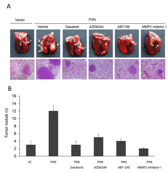 The number of lung metastatic tumor nodules in nude mice injected with PXN-overexpressing HT29 cells is strongly reduced by treatment with a Src inhibitor (Dasatinib), ERK inhibitor (AZD6244), MMP2 inhibitor I, or a Bcl-2 antagonist (ABT-199).