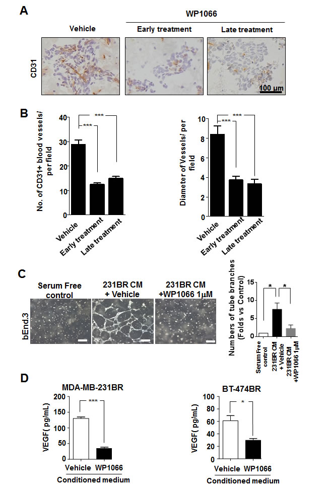 WP1066 inhibited angiogenesis of MDA-MB-231BR-cell