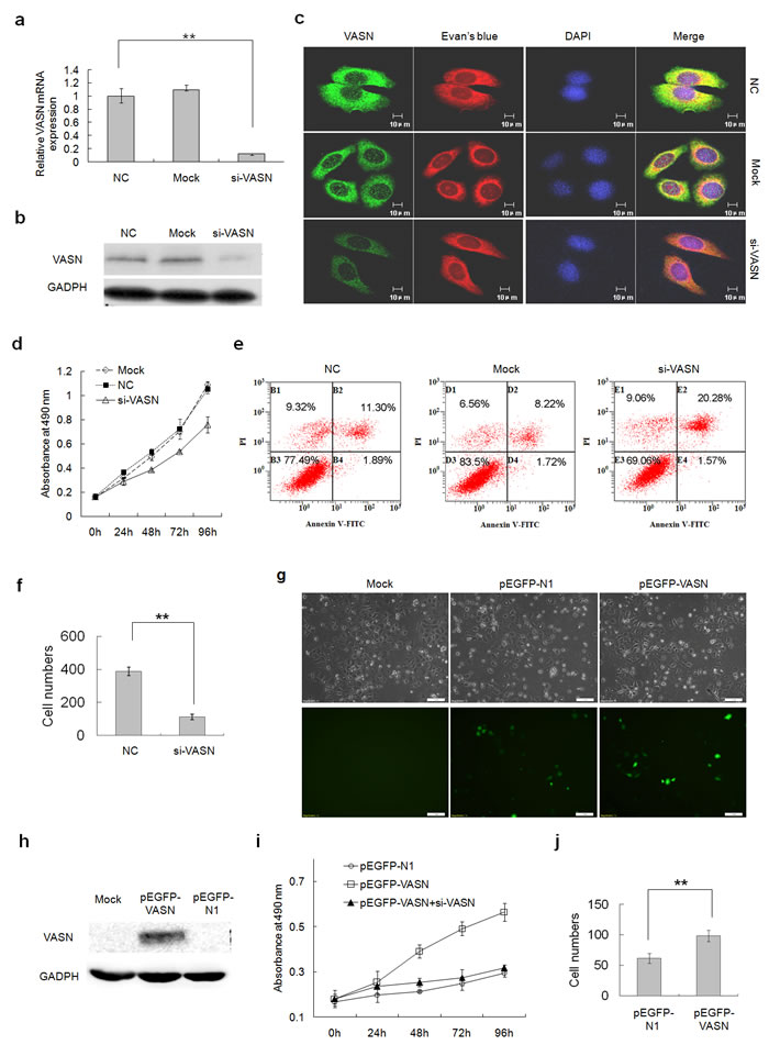 VASN increases hepatoma cell proliferation and migration and inhibited cell apoptosis.