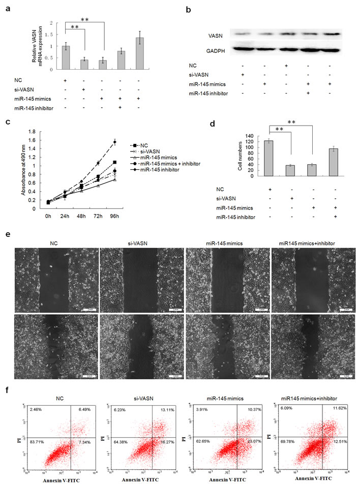 Transient overexpression of miR145 downregulated cell growth and migration and increased apoptosis through downregulation of VASN expression in HepG2 cells.