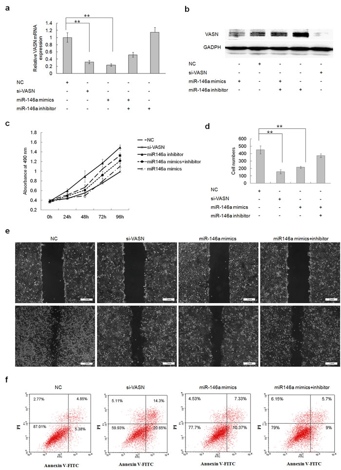 Forced Overexpression of miR146a downregulated cell growth and migration and increased cell apoptosis through downregulation of VASN expression in HepG2 cells.