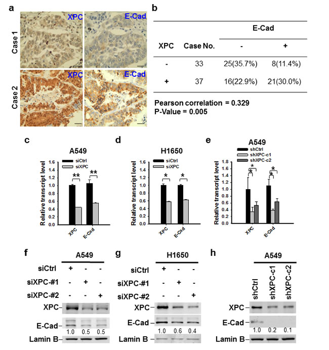XPC regulates the expression of E-Cadherin in NSCLC cells.