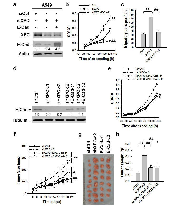 E-Cadherin is able to reverse the effect of XPC downregulation on cell growth.