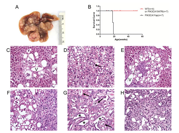 Histologic features of liver tumors developed in PIK3CA/Yap mice as assessed by H&amp;E staining.