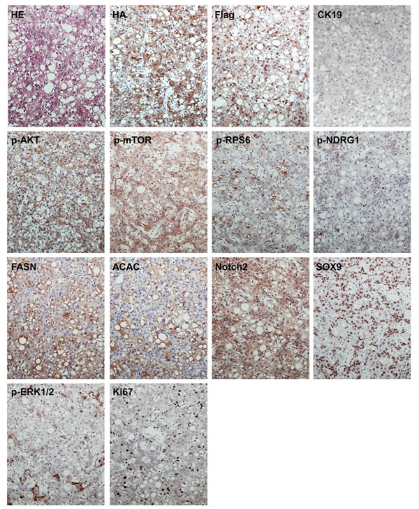Molecular characterization of hepatocellular tumors developed in PIK3CA/Yap mice.