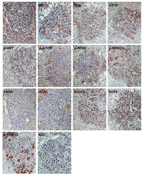 Molecular characterization of cholangiocellular tumors developed in PIK3CA/Yap mice.