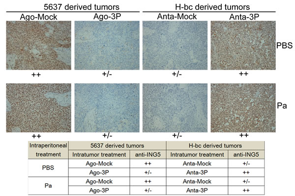 The ING5 level (immunohistochemical staining) in tissue slides of the miR-193a-3p agomiR-injected 5637 and miR-193a-3p antagomiR-injected H-bc tumor xenografts versus the NC-injected tumor xenografts.