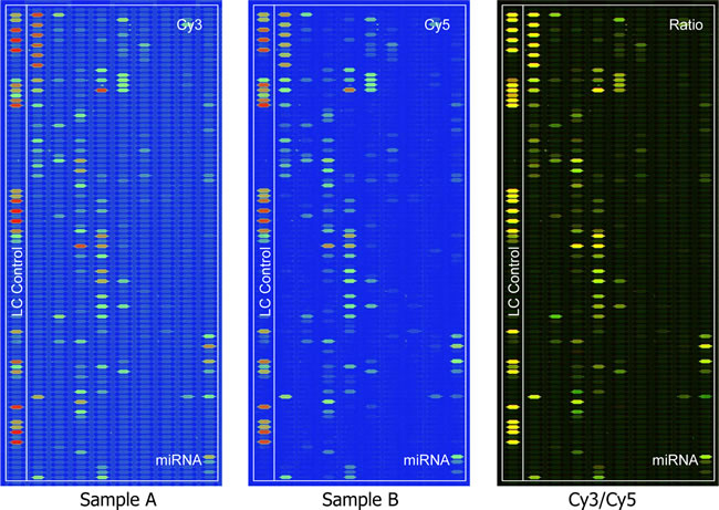 Different microRNA expression between F4 (Labeling Dye : Cy3) and F5M2 (Labeling Dye : Cy5) by the MicroRNA microarray.