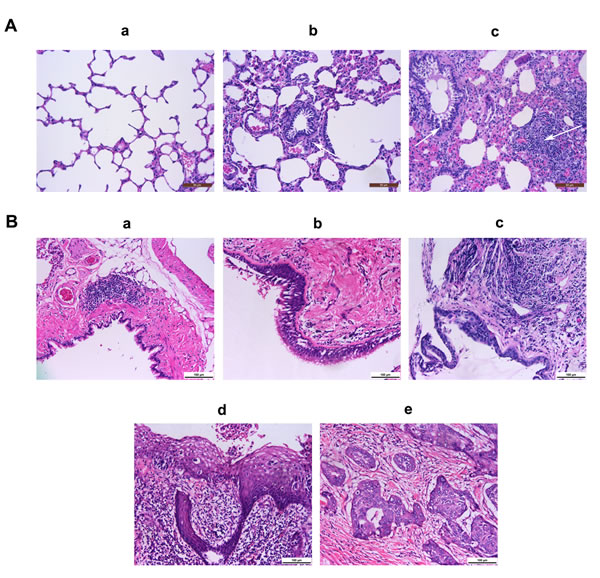 Fig.7: Representative images of airway inflammation and tumorigenesis in rats.