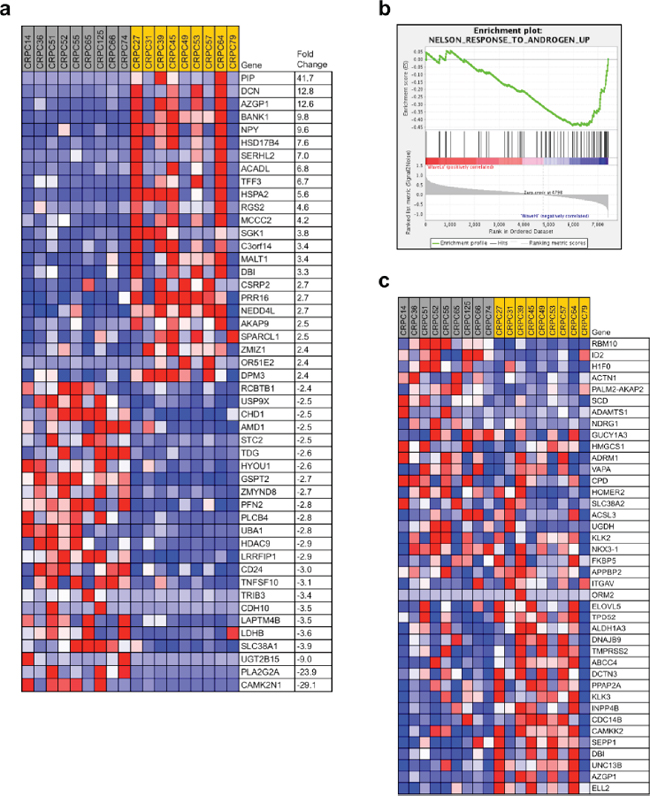 WASF1 deletion may identify an aggressive subtype of prostate cancer.