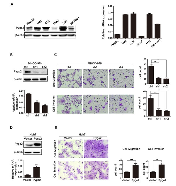 Pygo2 positively regulates invasion and migration of HCC tumor cells