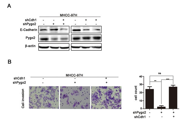 Pygo2 induces metastasis via regulation of E-cadherin.