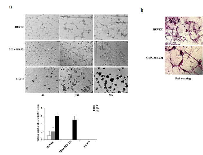 Kinetics of vascular channel formation in HUVEC, MDA-MB-231, and MCF-7 cells.