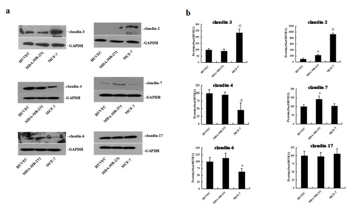 Expression of claudin-2, -3, -4, -6, -7, and -17 proteins in HUVEC, MDA-MB-231, and MCF-7 cells.