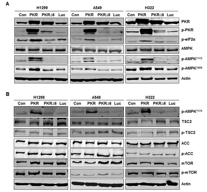 Inducing RNA-dependent protein kinase (PKR) mediates AMP-activated kinase (AMPK) activation in non-small cell lung cancer cells.