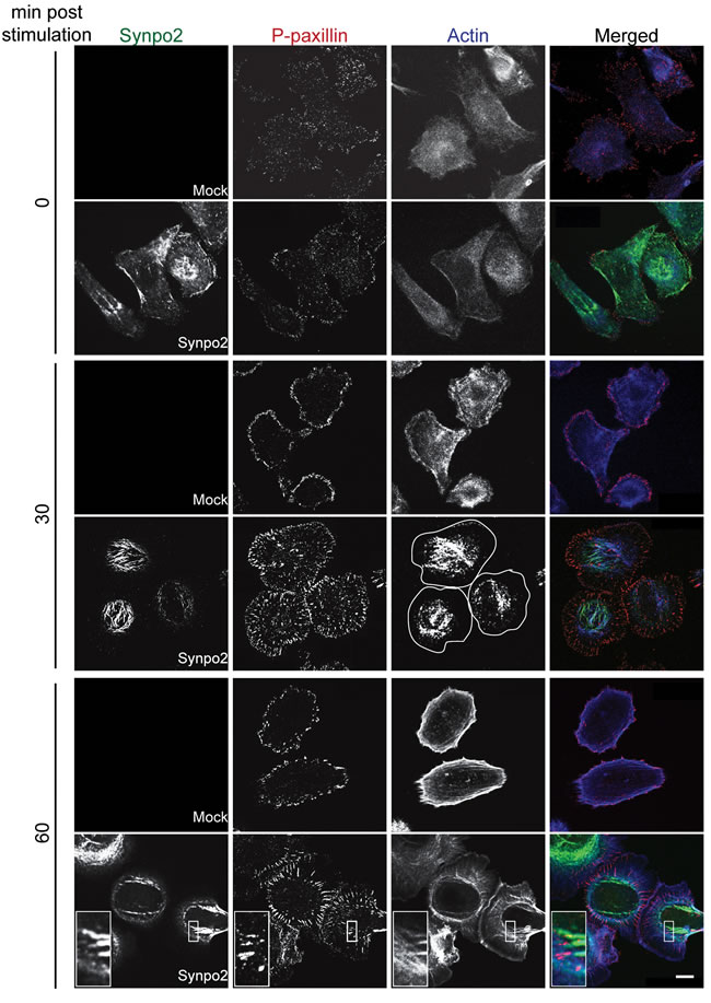 Focal adhesion maturation in Synpo2-expressing PC3 cells.