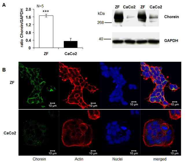 Chorein protein expression in ZF rhabdomyosarcoma cells and CaCo2 cells.