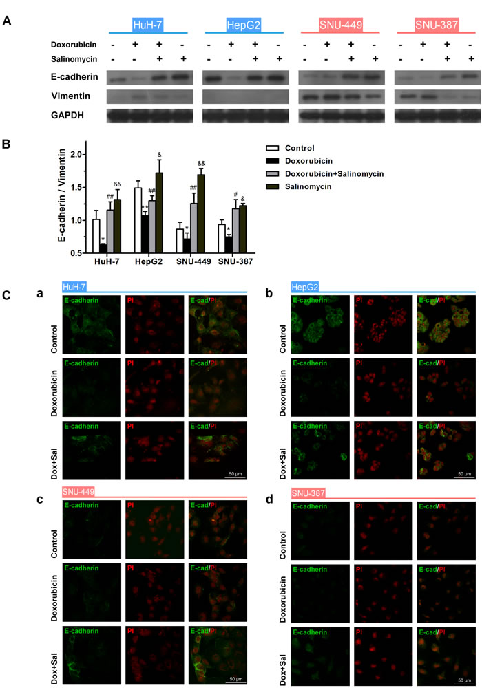 Salinomycin alters the expression of doxorubicin-induced EMT-markers in HCC cells.