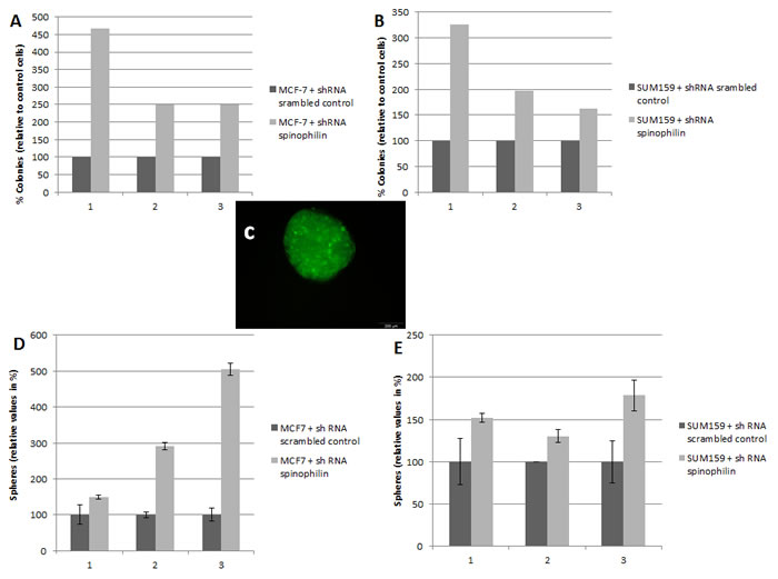 Silencing of spinophilin increases anchorage-independent growth and tumor sphere formation.