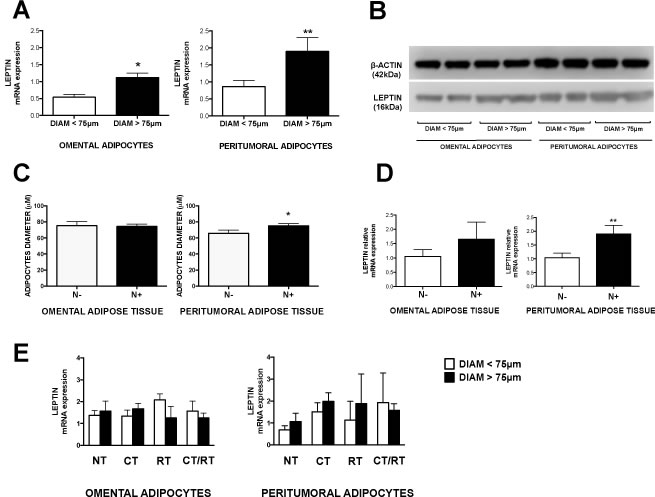 Leptin expression and adipocyte size in omental and peritumoral adipose tissue.