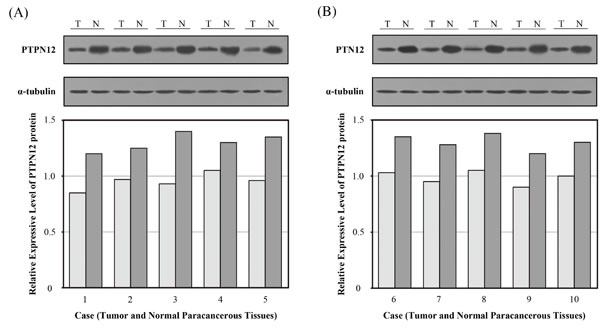 Expression of tyrosine-protein phosphatase non-receptor type 12 (PTPN12) in surgically resected lung tissues was determined by Western blot.