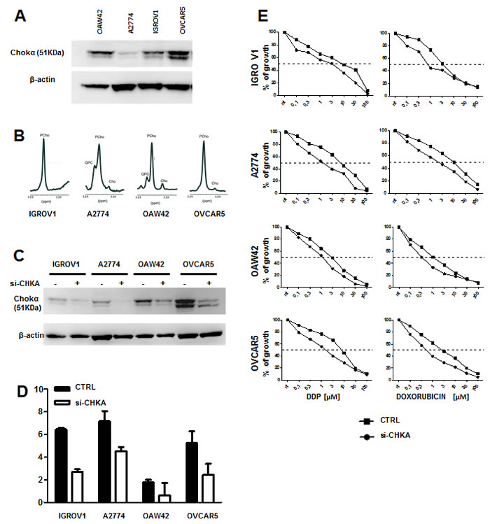 Alteration of GSH metabolism following CHKA silencing is a common feature of EOC cells.