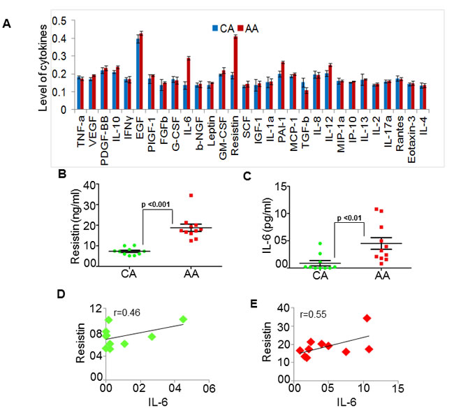 Resistin and IL-6 levels are high in serum of African American (AA) as compared to Caucasian American (CA) breast cancer patients.