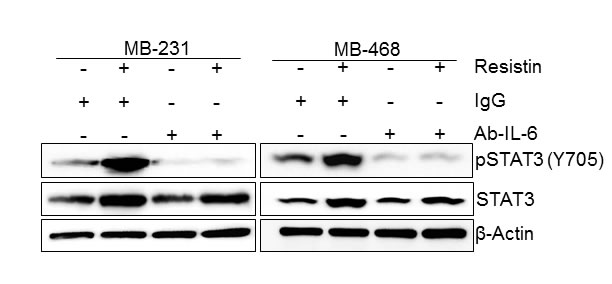 Resistin-induced phosphorylation of STAT3, but not its expression, is mediated through IL-6.