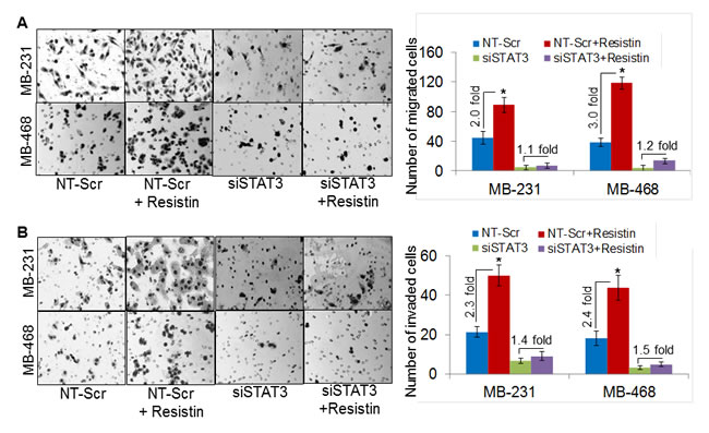 Silencing of STAT3 diminishes resistin-induced aggressiveness of breast cancer cells.