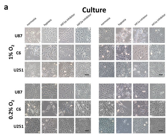 Morphologic changes and expression of EMT inducers and markers in glioma cell lines in response to hypoxia.