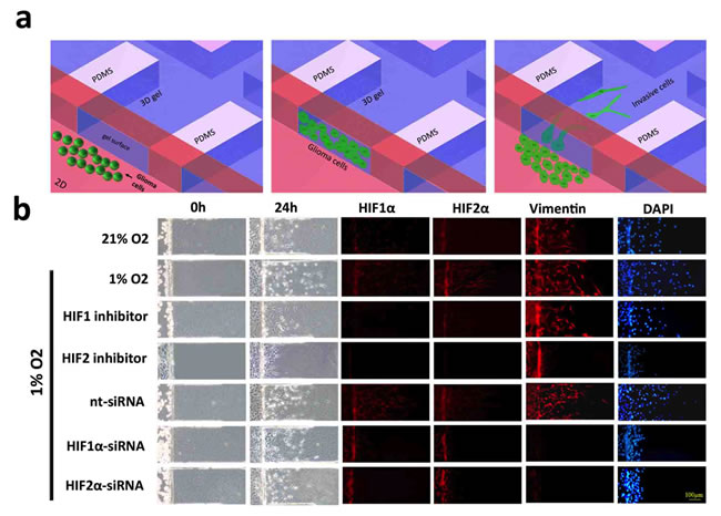 Microfluidic chip migration assay of U87 glioblastoma cells.