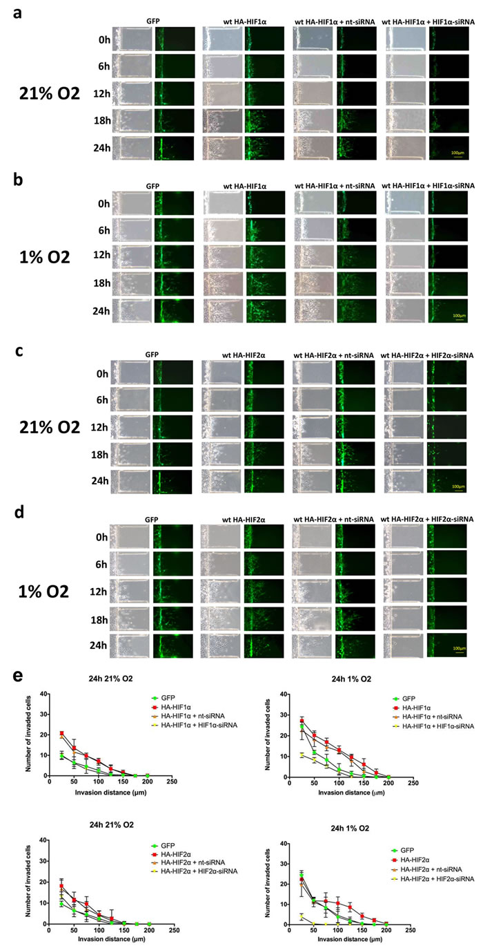 Time-course microfluidic chip migration assay of U87 glioma cells overexpressing HIF1&#x3b1; and HIF2&#x3b1;.