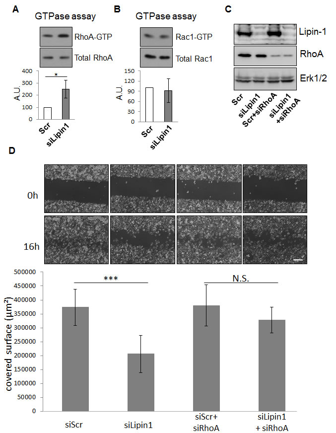 Fig.4: Lipin-1 silencing increased RhoA activity while Rac1 activity was not altered.