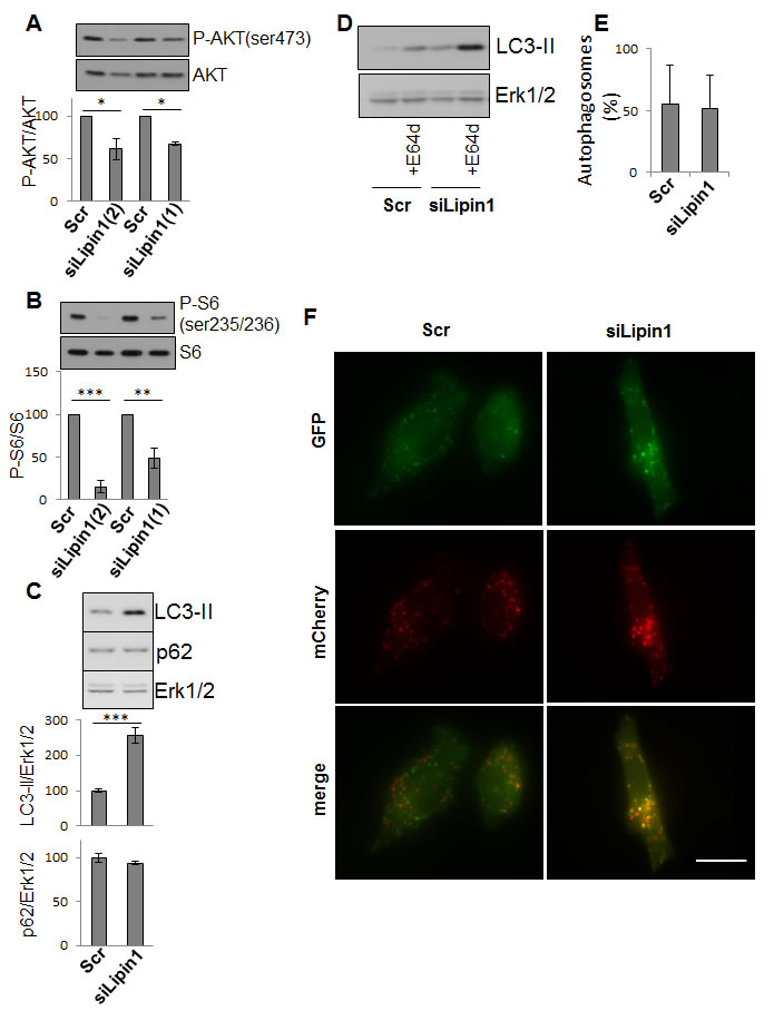 Fig.5: Lipin-1 silencing inhibited AKT and ribosomal protein S6 phosphorylation and enhanced autophagy.